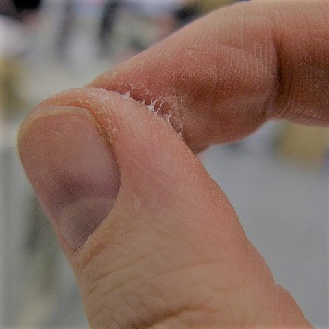 Como tirar super bonder do dedo em 7 dicas simples? Confira!